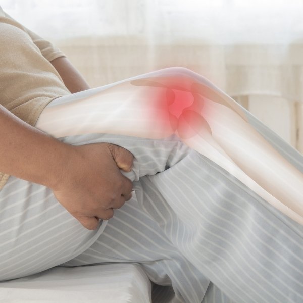 Tratamiento de Luxación de Rodilla en Santa Cruz